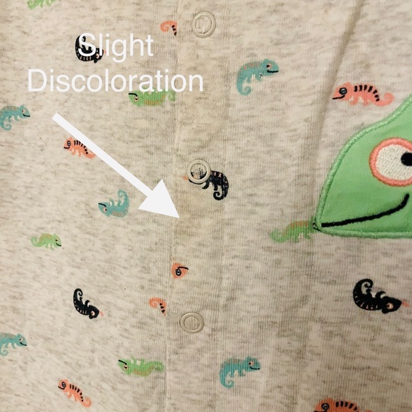 Gecko 🦎 Bodysuit - Picture 7 of 11